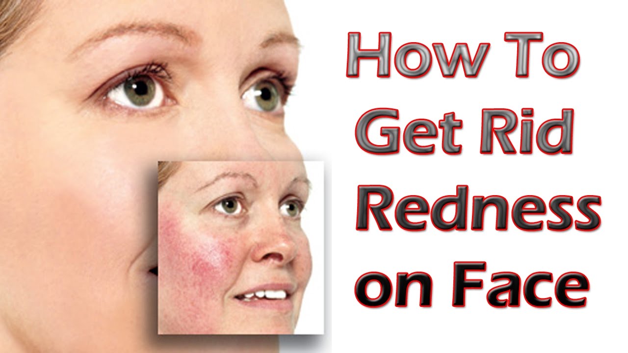 Clear facial redness