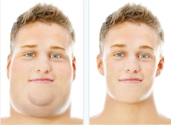 How to Reduce Neck Fat