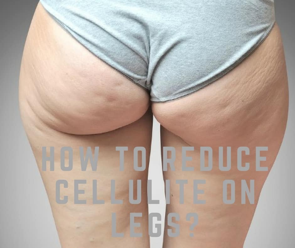 How to Reduce Cellulite?
