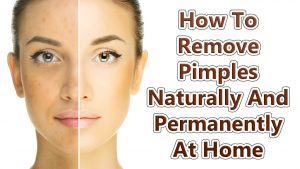 How To Reduce Pimples naturally at home