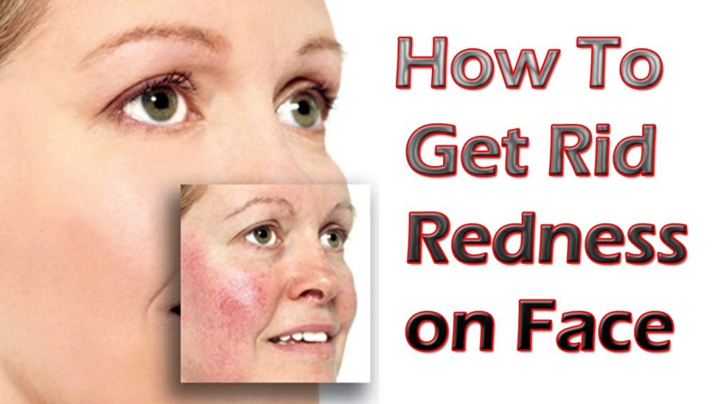 How To Reduce Face Redness
