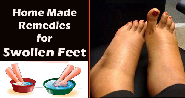 How to Reduce Foot Swelling