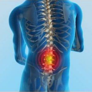 Natural Remedies for Back Pain and Inflammation