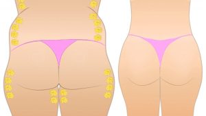  How to Reduce Hips and Thighs Naturally in 1 Week