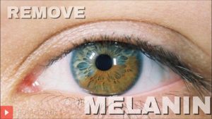 Naturally Reduce Melanin in Eyes